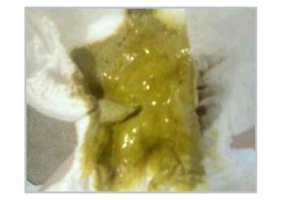 مدفوع نوزاد,انواع مدفوع نوزاد,مدفوع واقعی نوزاد